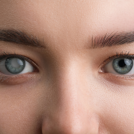 What is glaucoma?
